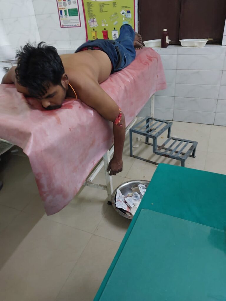 भालू ने एक युवक पर हमला कर दिया जिससे युवक गम्भीर रूप से घायल हो
